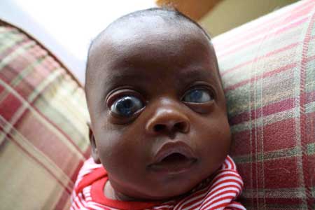 Garçon Franck Marck